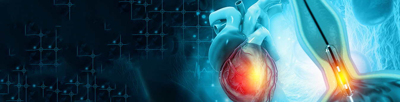 Coronary angiography: Purpose, Procedure and Recovery